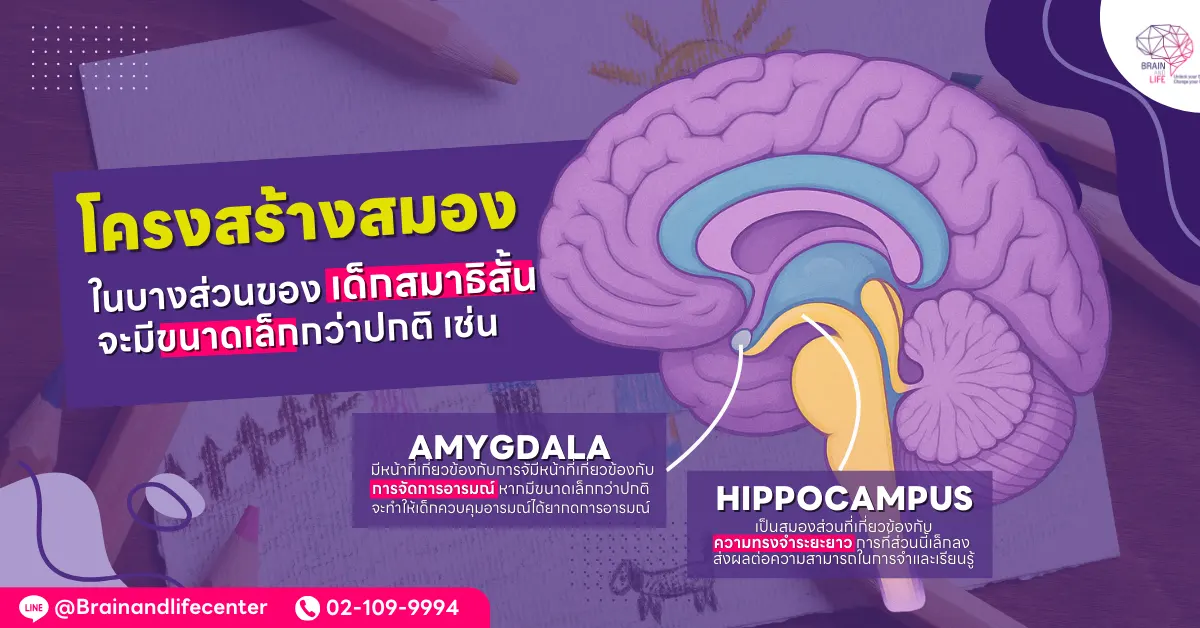 โครงสร้างสมอง เด็กสมาธิสั้น